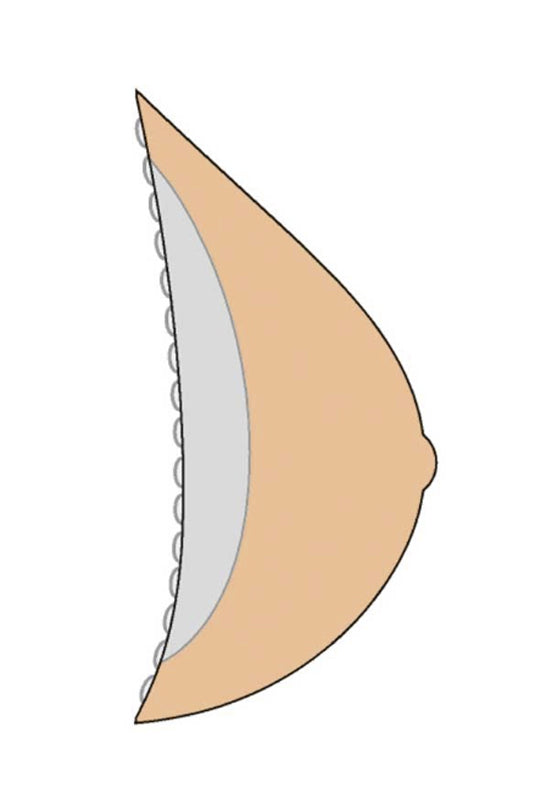 Amoena #383 2A Classic Contact Breast Form - Ivory
