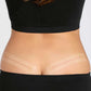 Amoena Strips Silicone Scar Patch | Clear | #010